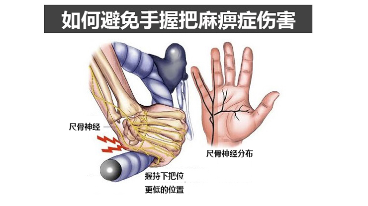 如何避免手握车把的麻痹疼痛？